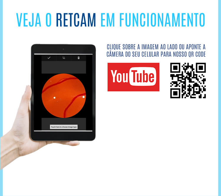Cadeira e Coluna