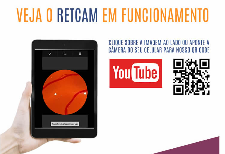 Cadeira e Coluna