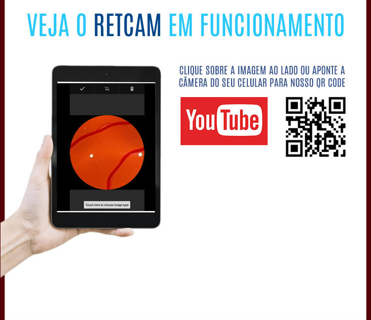 Cadeira e Coluna
