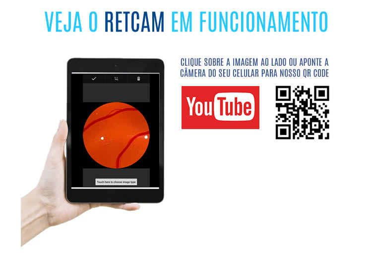Cadeira e Coluna